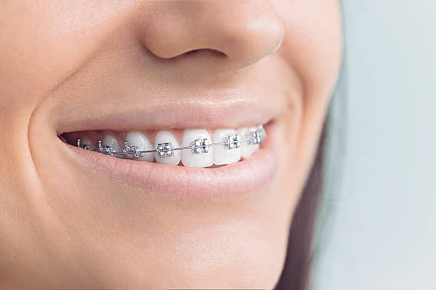 Best Traditional Braces  in Chincoteague, VA